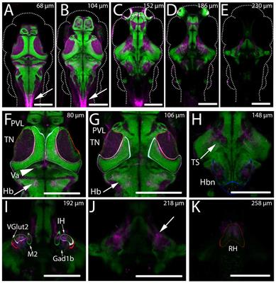 Hypothalamic Projections to the Optic Tectum in Larval Zebrafish